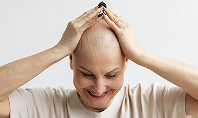 Alopecia femminile androgenetica